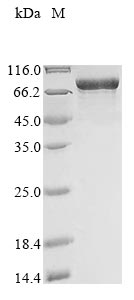 Recombinant Human Myosin-6 (MYH6), partial (160-816aa), N-terminal 10xHis-tagged, E.coli expression - 1 mg