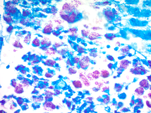 The Fite's Stain Kit (For Leprosy) - 125 mL