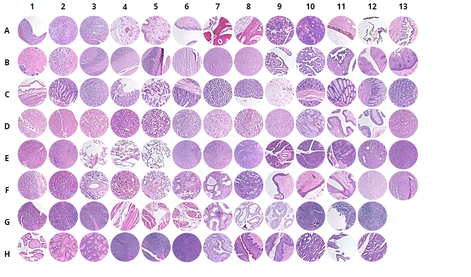 Normal human tissues, FDA, 35 organs in triplicates (1.5 mm) - 8 Row/13 Column